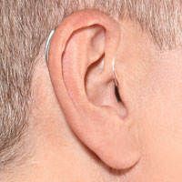 Aide auditive contour d'oreille sur oreille BTE